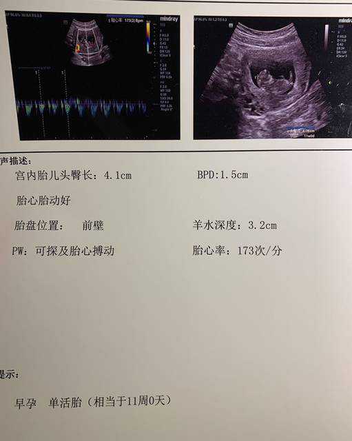 上海代生哪里专业，宫颈癌的治疗上海哪家医院更专业