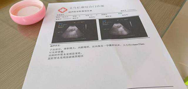 上海做代孕医院排名，上海哪些医院可以做三代试管？卫健委最新获批名单！