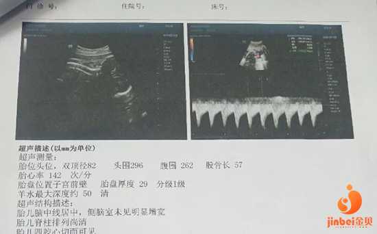 广东供卵机构,【广东有合法的供卵机构吗】孕41周剖腹产男宝一枚，附过程和孕