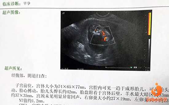 广州卵巢早衰供卵助孕电话，广东康健可以供卵吗